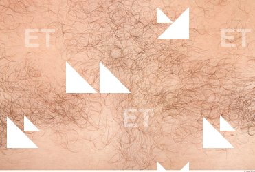 Hairy Skins