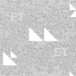 Seamless Metal